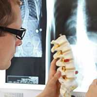 Facts About Spinal Fusion You May Not Know