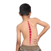 Scoliosis Facts for All Parents to Know