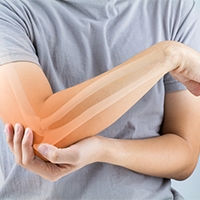 What You Should Know About An Elbow Fracture Injury